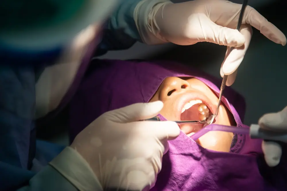 Wisdom Teeth Removal Paullgregory (3)