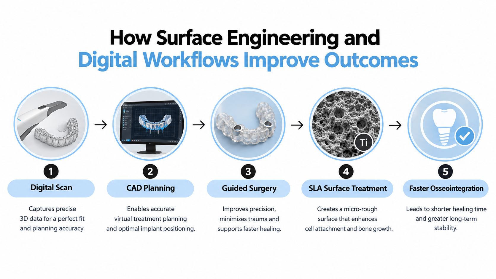 A five-step digital dental workflow process showing scanning, planning, guided surgery, and implant surface treatment for osseointegration.