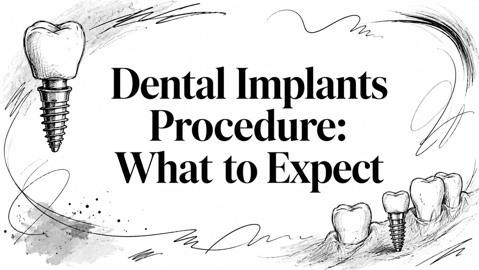Dental Implants Procedure Dental Implants
