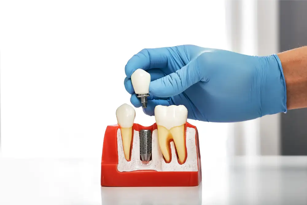 Dental Implants Services in Manhattan, NY