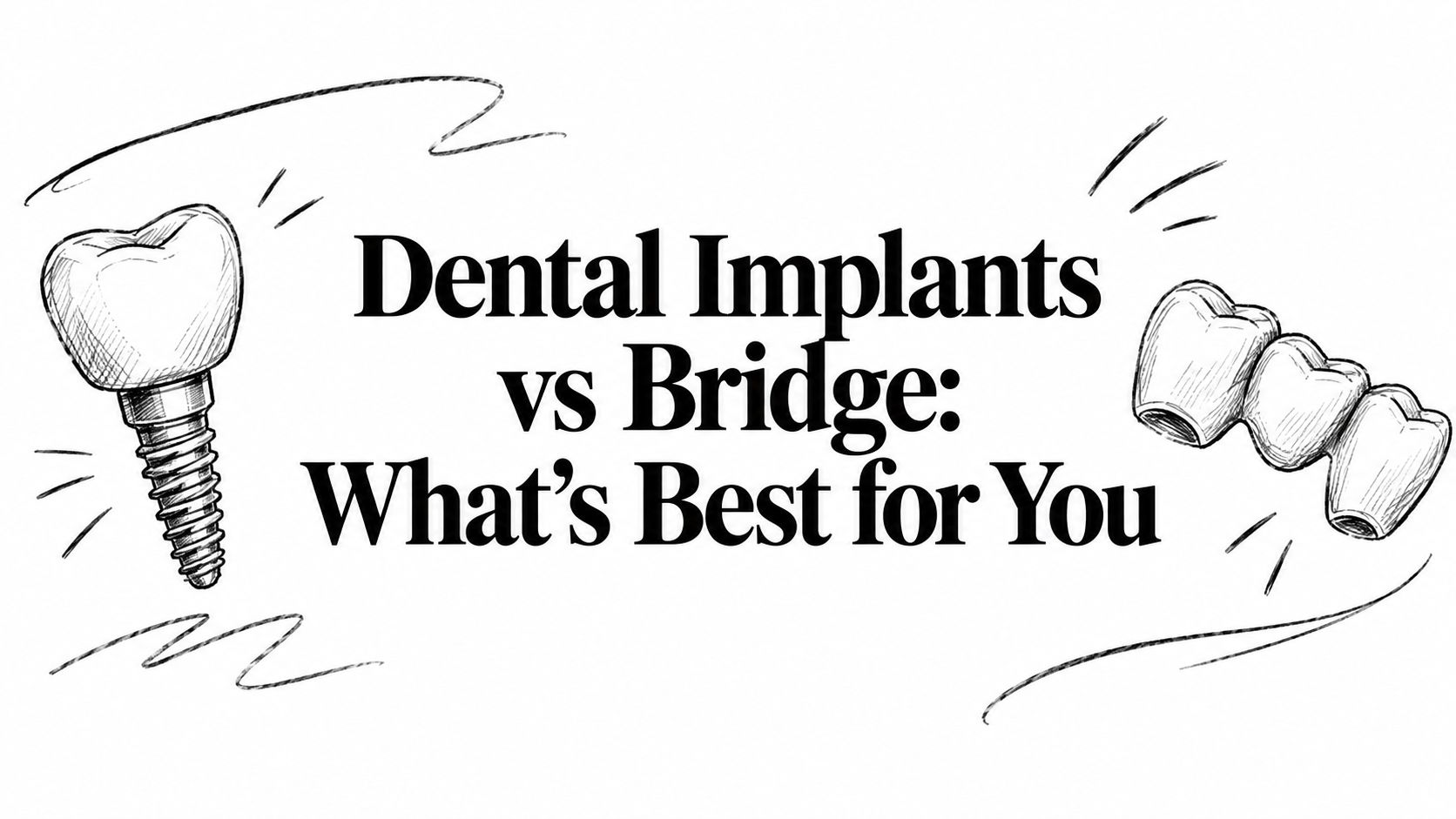 Dental Implants vs Bridge: What’s Best for You