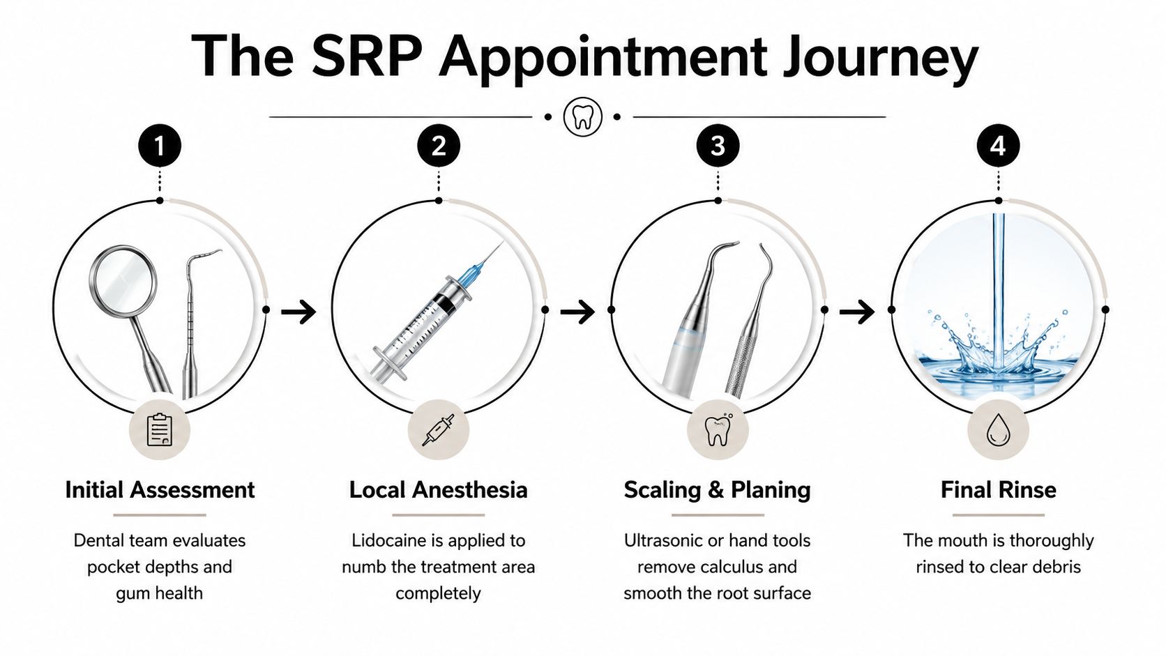 A four-step infographic illustrating the periodontal scaling and root planing treatment process from assessment to rinsing.