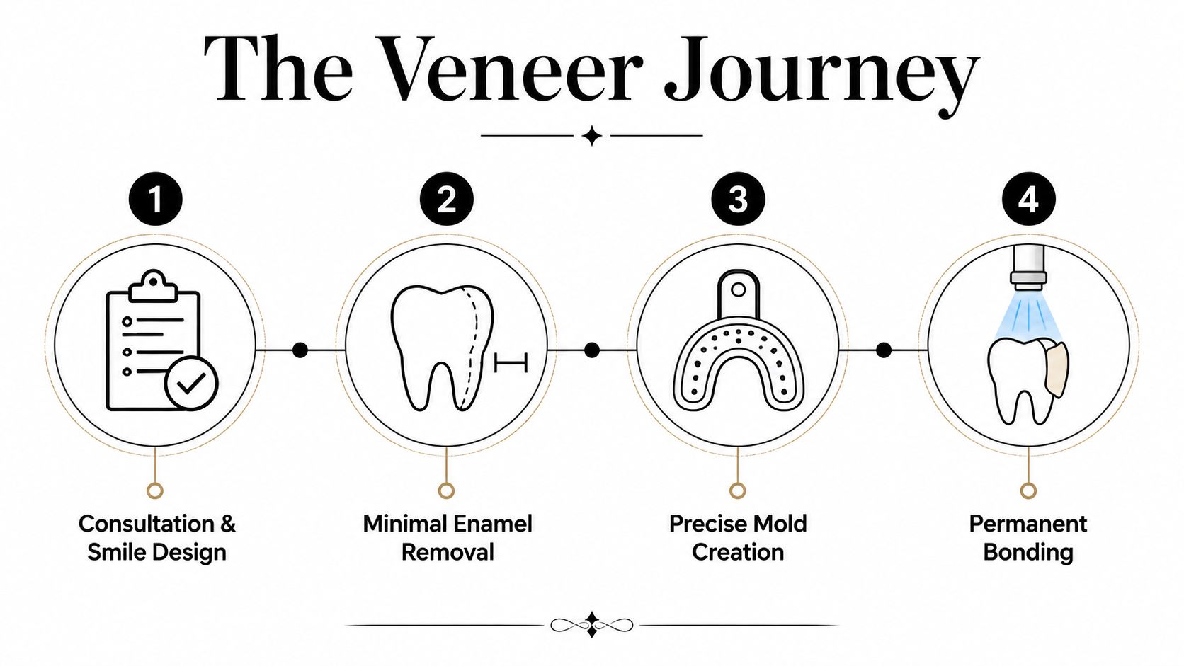 A diagram illustrating the four-step process for getting dental veneers, from consultation to permanent bonding.
