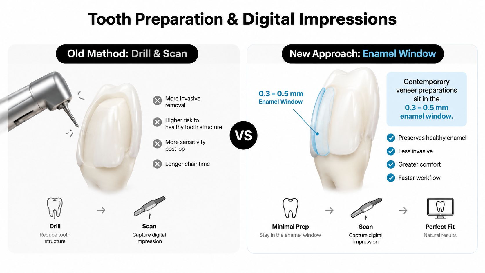 A dental comparison infographic showing traditional drilling versus the modern enamel window technique for porcelain veneers process.