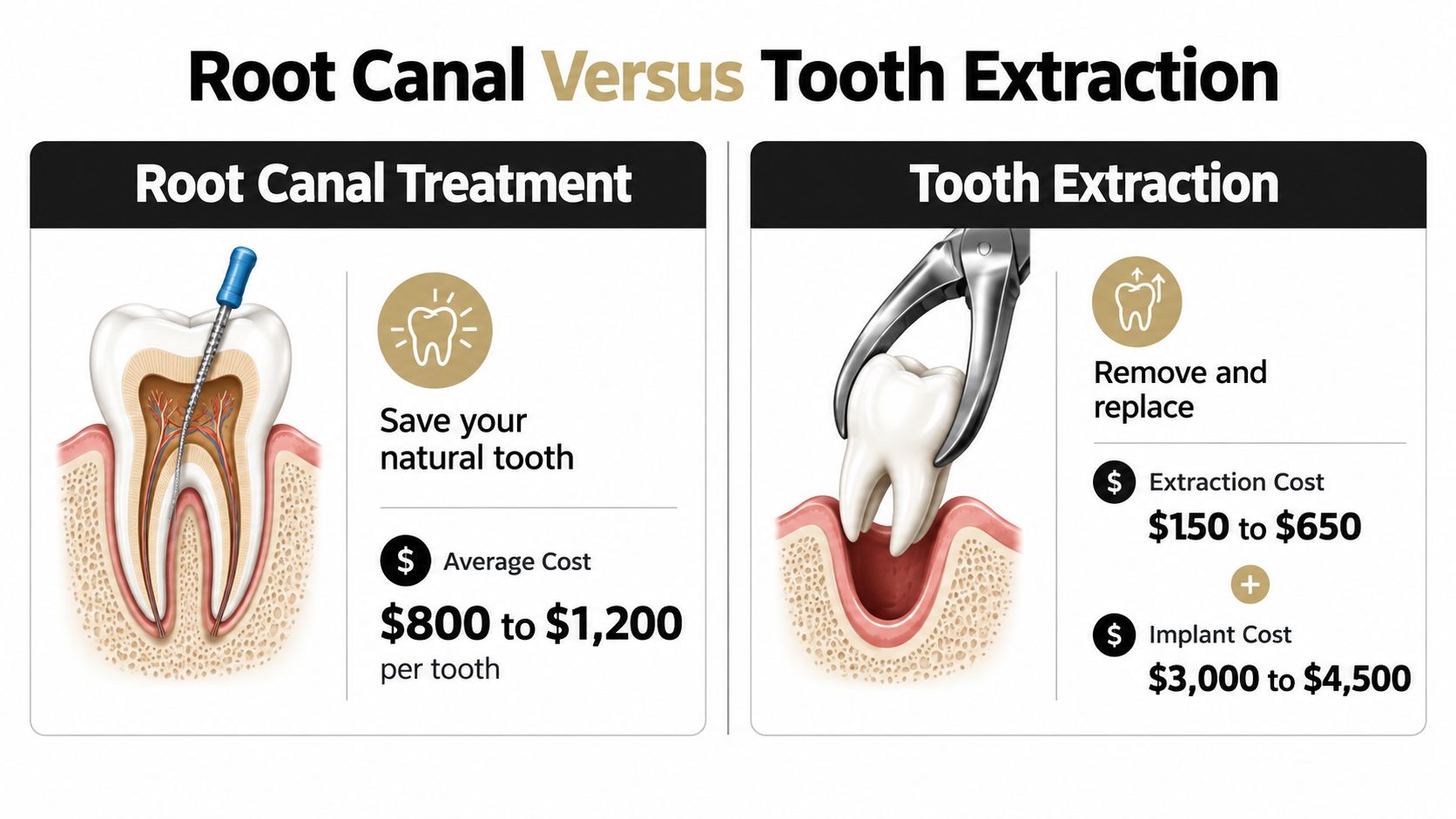 An infographic comparing the costs and procedures of root canal treatment versus tooth extraction with implants.