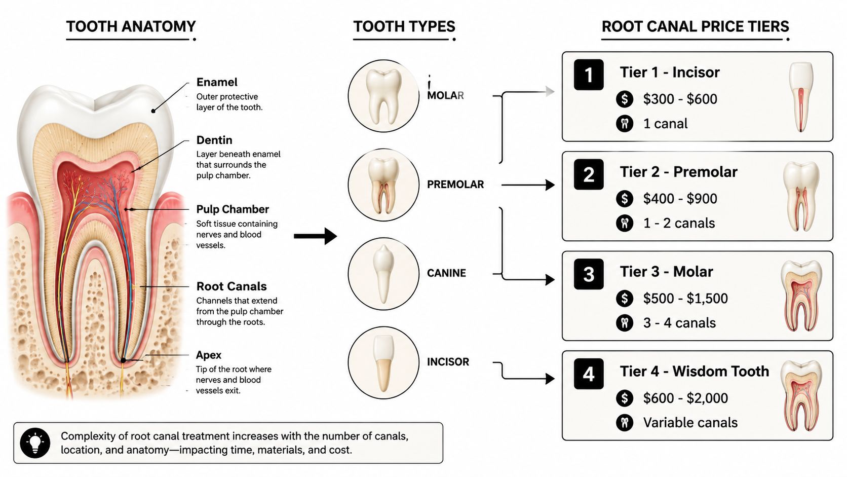 An infographic illustrating tooth anatomy, tooth types, and root canal price tiers based on complexity.