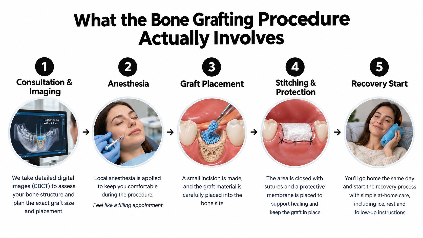 A five-step infographic illustrating the dental bone grafting procedure from initial consultation to recovery.